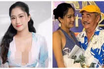 Bạn gái NSND Việt Anh mặc táo bạo hậu "dao kéo"