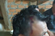 Lại xảy ra đụng độ vì dự án điện gió, nhiều người dân bị thương