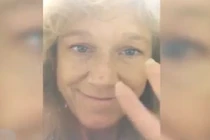 Điều kỳ diệu khi dùng huyết thanh dưỡng da xóa nếp nhăn