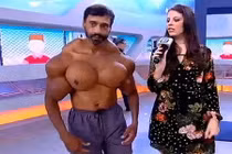 Người đàn ông có cơ bắp kỳ dị to như quả bưởi