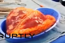 Sự thật kinh ngạc về quả tim của người nghiện ma túy