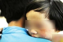 Bé gái 5 tuổi mắc bệnh... lậu vì anh hàng xóm