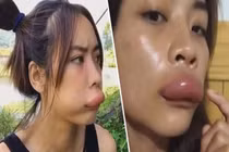 Chơi dại phá tổ ong, cô gái nhận cái kết không thể đắng hơn