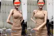 Hoảng hốt với cô gái thân hình mỏng tang vì giảm cân quá đà