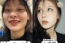 Sau 4 năm học đại học, cô gái bình thường hóa thành mỹ nữ