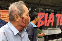 Tranh giành “địa bàn”, xe ôm đánh ông cụ 80 tuổi gãy xương sườn gây phẫn nộ