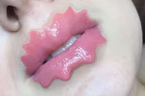 Khiếp đảm với trào lưu đôi môi hình răng cưa của giới trẻ