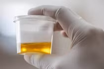 4 dấu hiệu cảnh báo bệnh sau khi uống nước, nếu có cần khám gấp