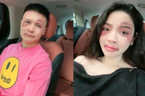 Vợ chồng Quang Hải thâm tím mặt mày, chuyện gì đã xảy ra?