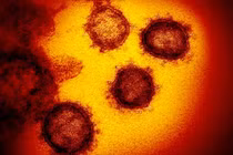 Tiết lộ hình ảnh chân thực của Covid-19 nằm giữa tế bào người