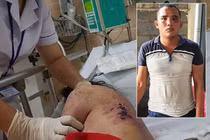 Lời khai của kẻ tra tấn nữ nhân viên như thời trung cổ vì từ chối kích dục