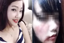 Gái xinh cắn cướp gãy răng, lỡ mồm bị đánh bầm dập?