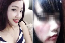 Gái xinh cắn cướp gãy răng, lỡ mồm bị đánh bầm dập?