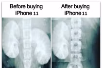 Chờ ra mắt iPhone 11, dân mạng chế ảnh “bán thận“ mua siêu phẩm "táo cắn dở"