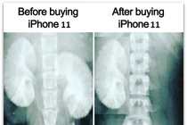 Chờ ra mắt iPhone 11, dân mạng chế ảnh “bán thận“ mua siêu phẩm "táo cắn dở"