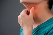 Đau họng thường xuyên đừng chủ quan, coi chừng ung thư