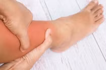 Có 3 biểu hiện này, máu đông đang “rình mò” bạn