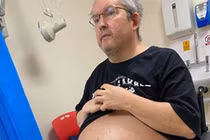 Mắc bệnh lạ như mang thai, người đàn ông phát hiện sự thật kinh dị 