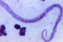 Chàng trai đau vùng kín, đi khám phát hiện điều ghê rợn