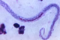 Chàng trai đau vùng kín, đi khám phát hiện điều ghê rợn