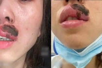 Đang ngủ thấy môi đau nhói, tỉnh dậy phát hiện chuyện kinh dị