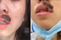 Đang ngủ thấy môi đau nhói, tỉnh dậy phát hiện chuyện kinh dị