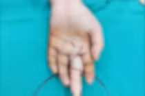 Nhẫn quá chật, cô gái làm điều này khiến ngón tay chỉ còn...xương trắng