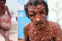 Người đàn ông hóa quỷ, khiến dân làng sợ hãi tránh mặt và sự thật đau lòng