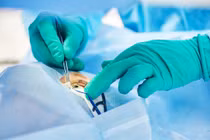 Đi mổ cận, người đàn ông bàng hoàng khi mắt thành viễn thị 