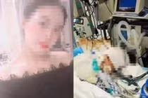 Phẫu thuật thẩm mỹ nâng mũi, cô gái tử vong vì điều không ngờ