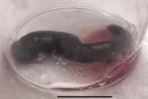 Bé gái chảy máu cam liên tục, hóa ra do “quái vật” hút máu