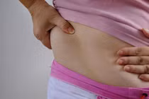 Chân tay nhỏ nhưng bụng to, hóa ra khối u “khủng” làm tổ