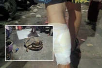 Đi tiểu bậy, người đàn ông bị trăn khổng lồ “dạy dỗ” gây choáng