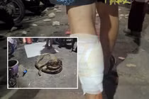 Đi tiểu bậy, người đàn ông bị trăn khổng lồ “dạy dỗ” gây choáng