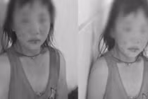 Bé gái bị mẹ kế đánh đập dã man khiến hàng xóm phẫn nộ