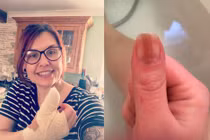Đường chỉ đỏ xuất hiện ở móng tay, nữ y tá bàng hoàng phát hiện sự thật 