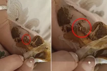 Con gái sốt lại chữa theo cách của tiệm massage, mẹ ân hận