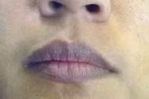 3 vùng trên cơ thể phụ nữ sẫm màu chứng tỏ tử cung rất bẩn