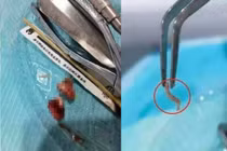 Khám răng, bệnh nhân khiến bác sĩ sợ chết khiếp khi thấy "quái vật"