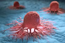 Khi tế bào ung thư lan rộng, cơ thể phát những tín hiệu này