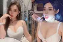 Mặc quá hở hang, hot girl đi khám răng khiến người khác đỏ mặt 