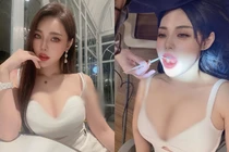 Mặc quá hở hang, hot girl đi khám răng khiến người khác đỏ mặt 