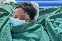 Uống thuốc cảm khi sốt, bé trai bị lột da toàn thân vì...