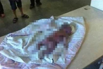 Chó hoang đột nhập phòng sinh, bố bất lực chứng kiến con trai bị cắn chết