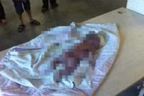 Chó hoang đột nhập phòng sinh, bố bất lực chứng kiến con trai bị cắn chết