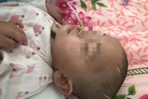 Ăn kẹo ông trẻ đưa, bé gái 2 tuổi sùi bọt mép suýt chết