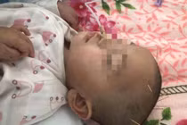 Ăn kẹo ông trẻ đưa, bé gái 2 tuổi sùi bọt mép suýt chết