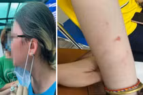 Bộ GD&ĐT chỉ đạo xử lý vụ bạo lực trong học sinh trường Quốc tế TP.HCM