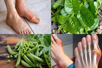 2 loại rau “đồng bọn” bệnh gút, ăn vài miếng đã hại cơ thể 