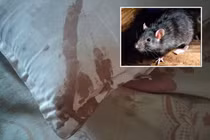 Đang ngủ thì cổ đau nhói, tỉnh dậy phát hiện điều ghê rợn 